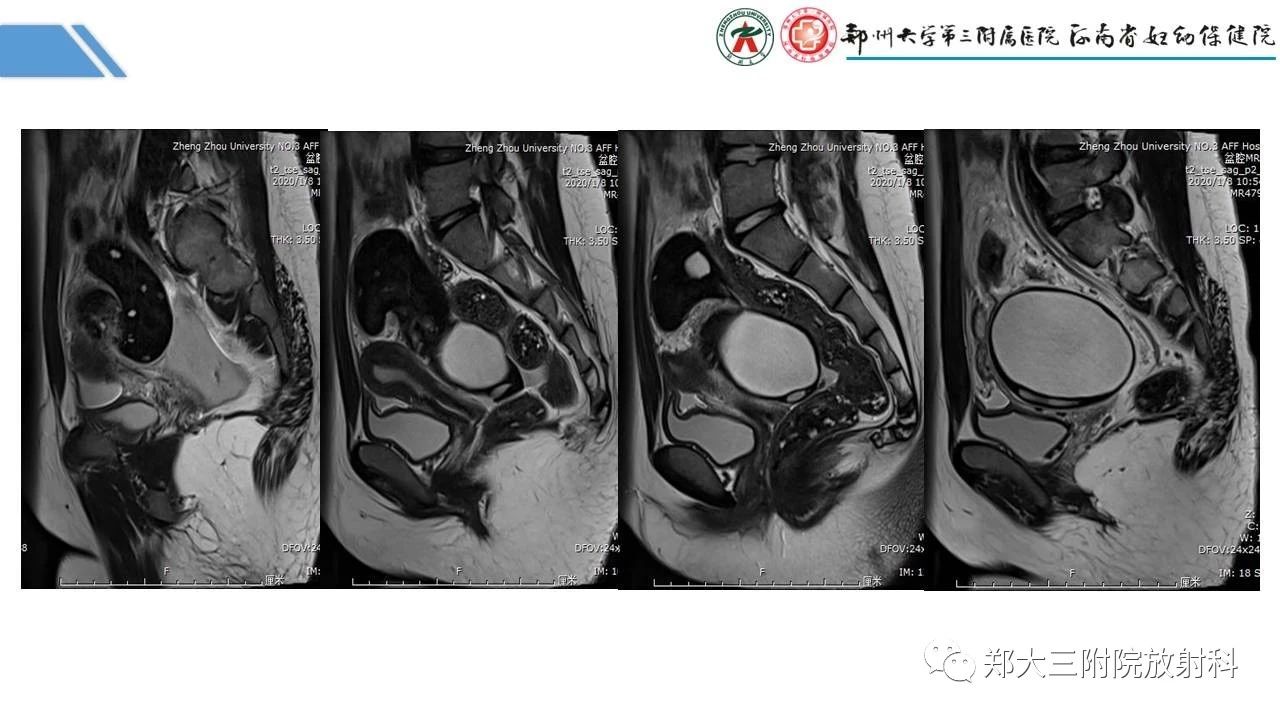 e189a5ea2c6e999fd9e442cf9902917c.jpg