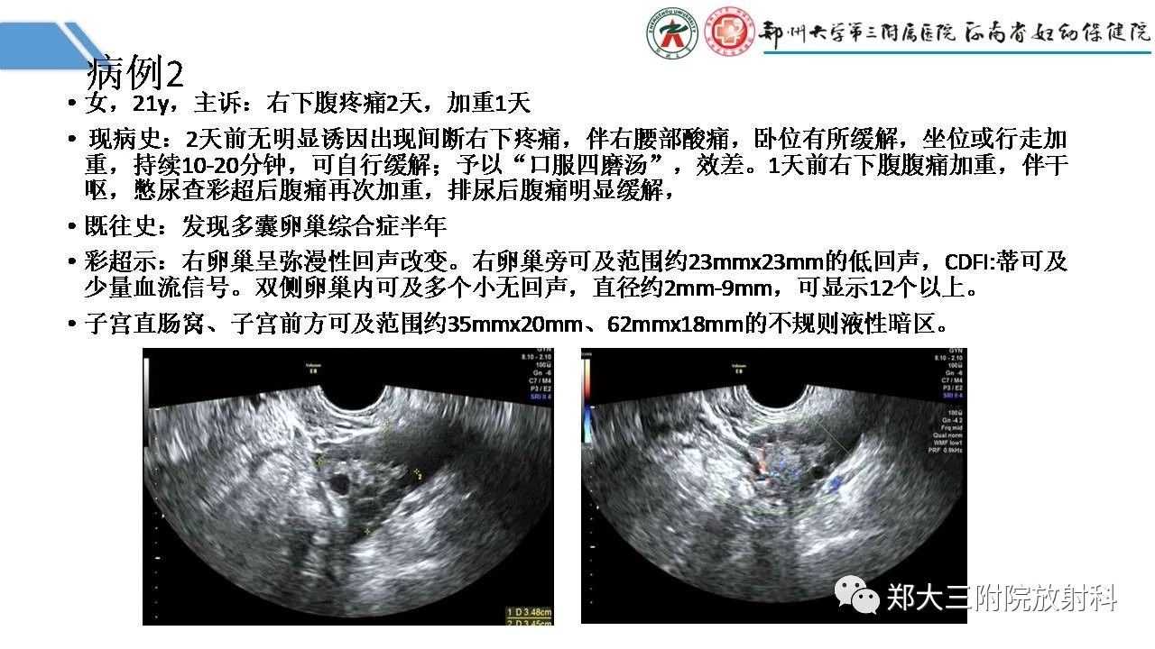 d575fa6e5193a3c46a066051cdffbaef.jpg