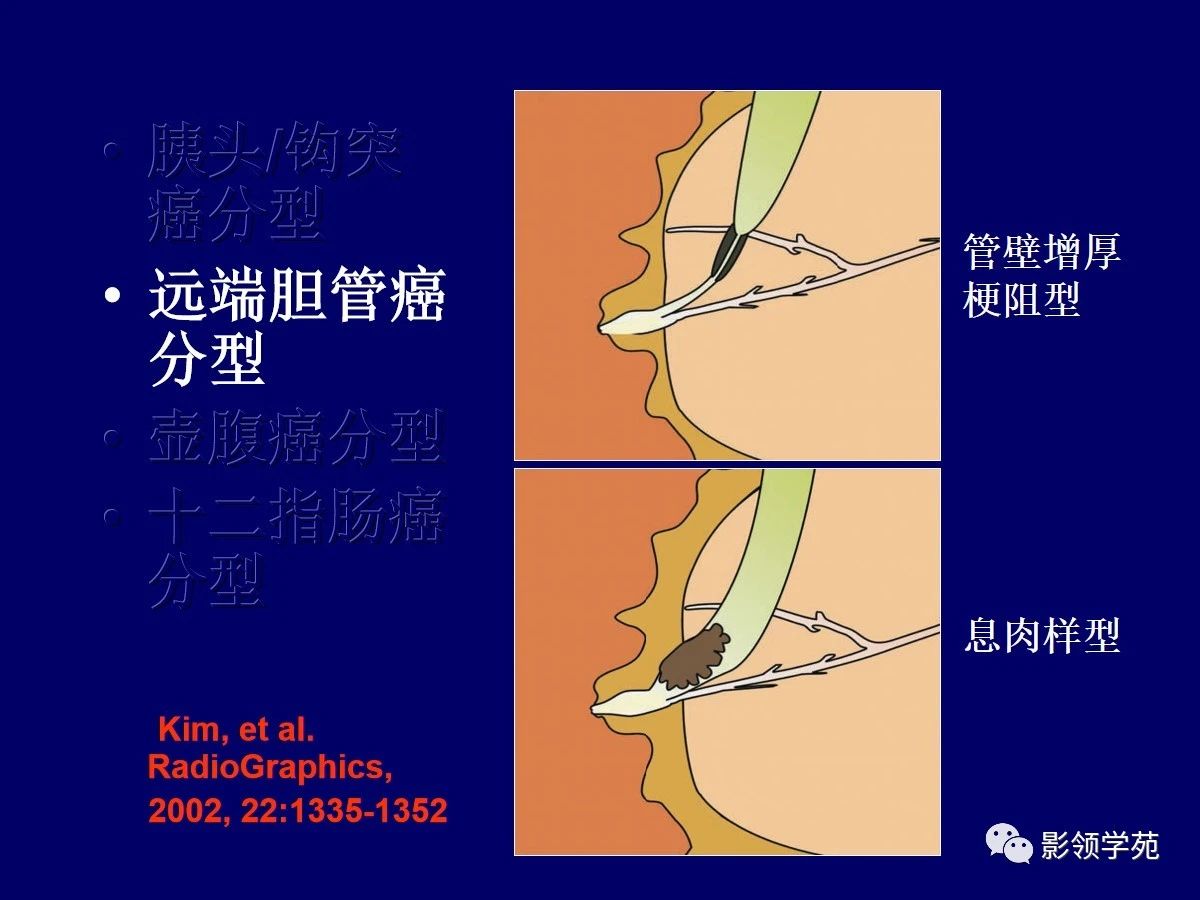 fadfb18ffb3d2d4663b770bc1fbfdb83.jpg