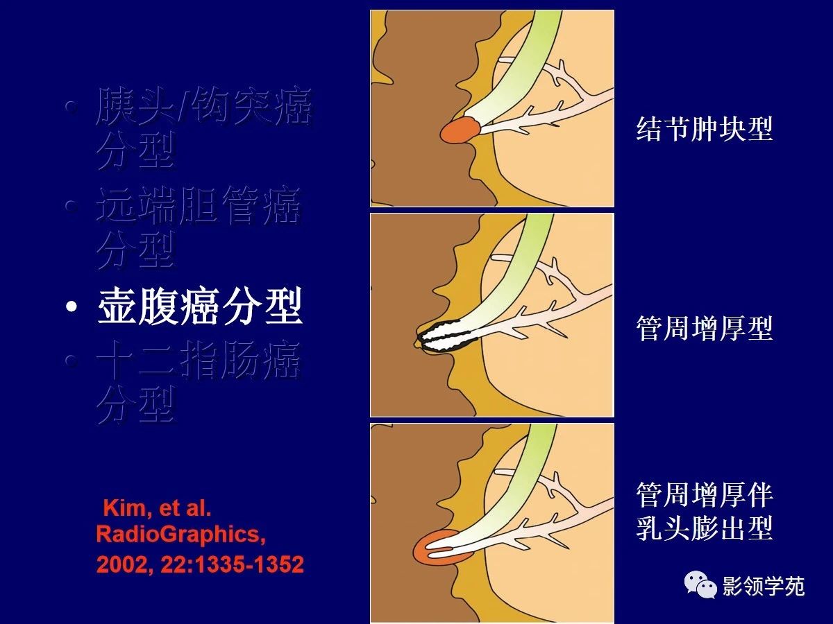 3bf151ab975a493fd0aec255dfa5319b.jpg