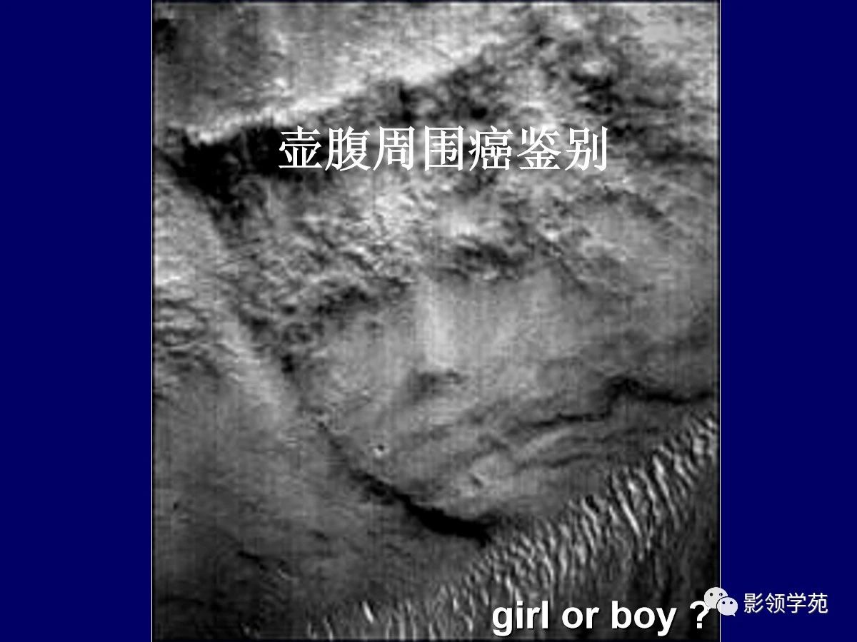 964aa2739238ae6c095410a6f609aaaf.jpg