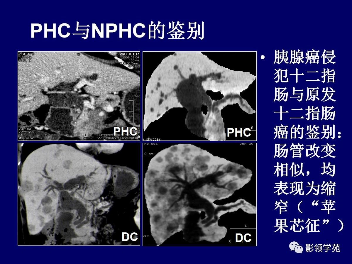 b6a105cef516b94be0391b574186732b.jpg