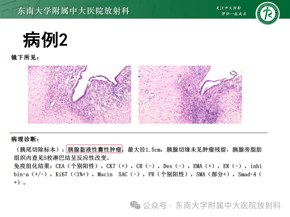e5ec503778a8eef1a6de4ee078188d2b.png