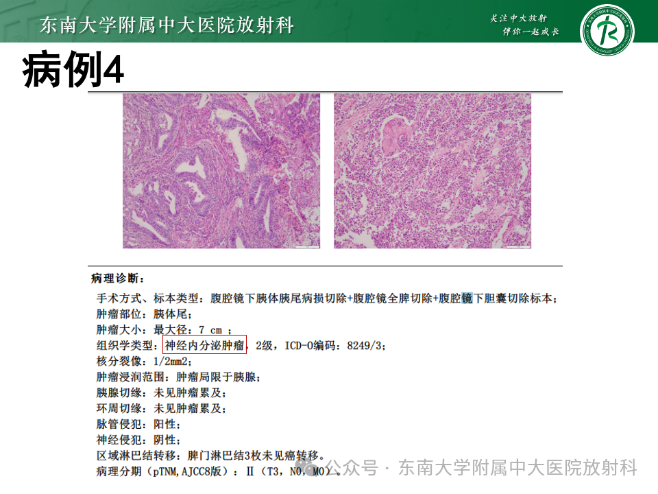 e04ca39eb9f3355eea031fe57cd6be04.png