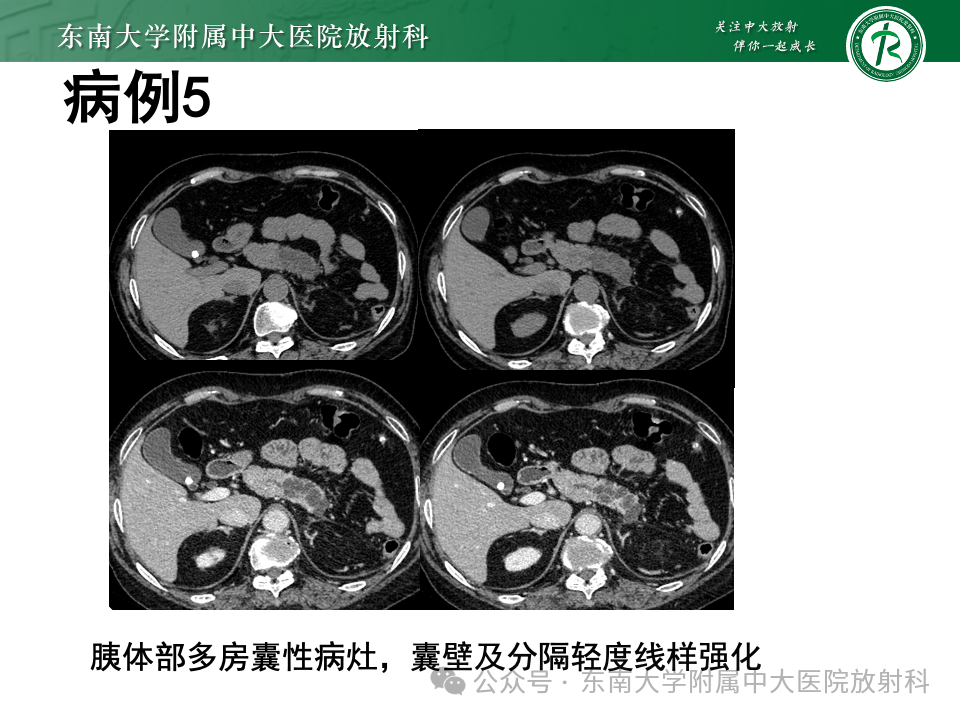 aaa62b84b8e604b1526496cd35a94a37.png