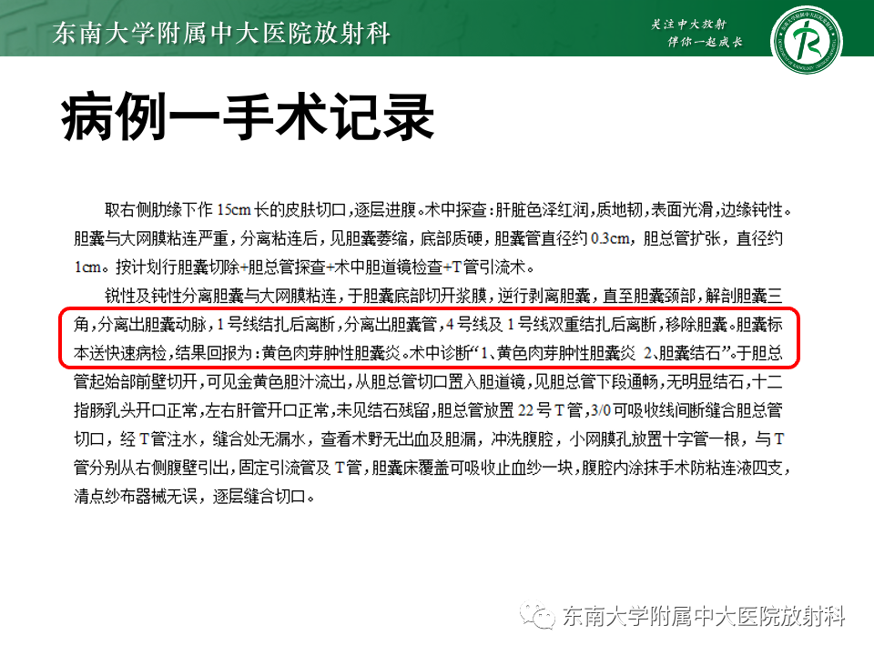 ba74235b05d3428cd3dc0d3935c6ccd9.png