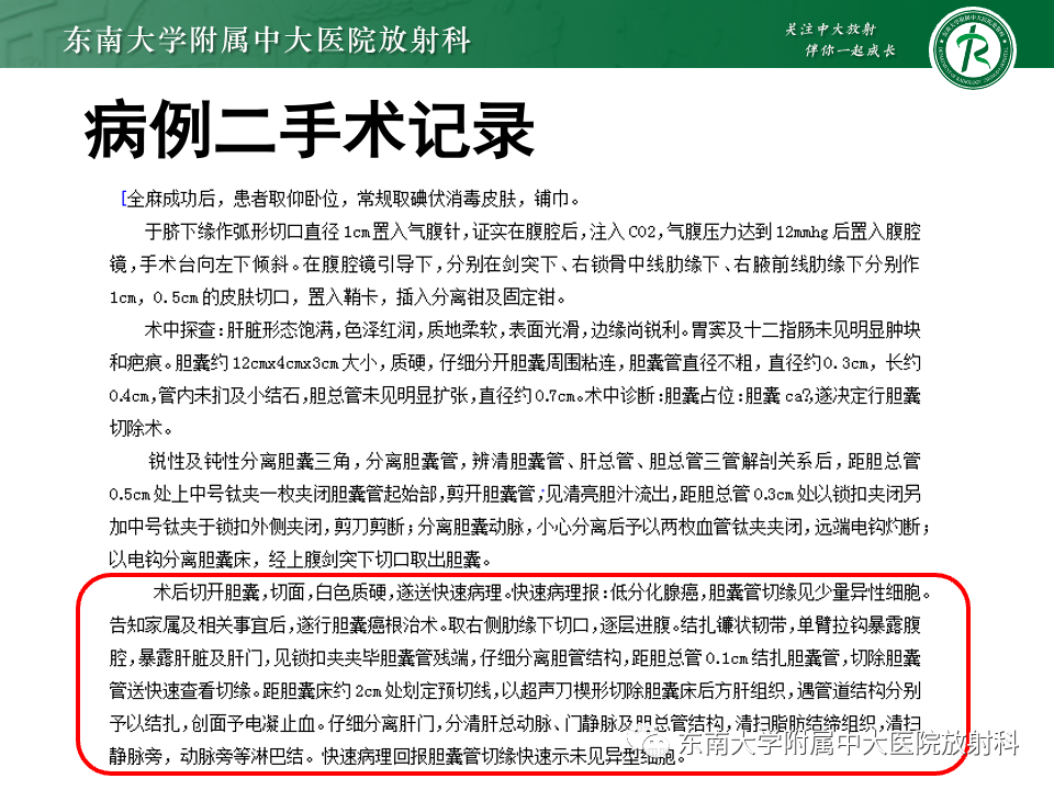 5a0eb191fc372428bb280d82d986f402.png