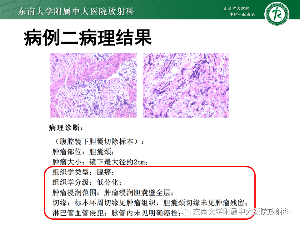 d569e64327b2825409ff2f208b72cb7f.png