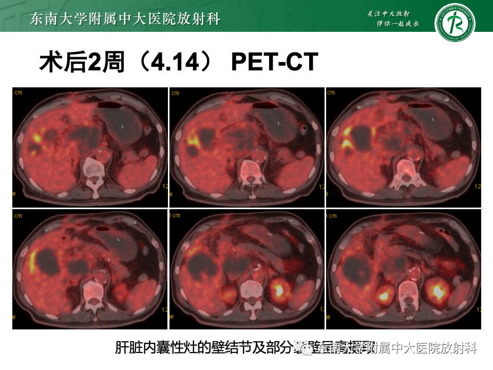 b95a05713acab7c86c4165148b9fd3bb.png