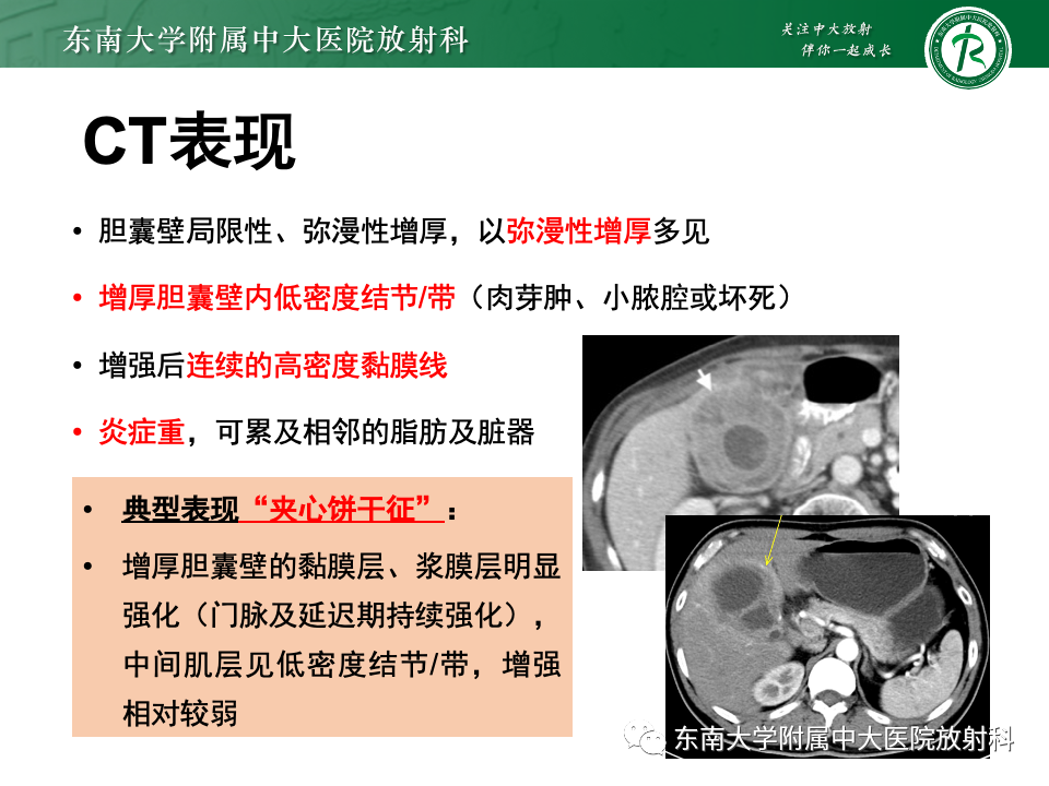 dc1dc9d8a29cf8d190ab10db42433001.png