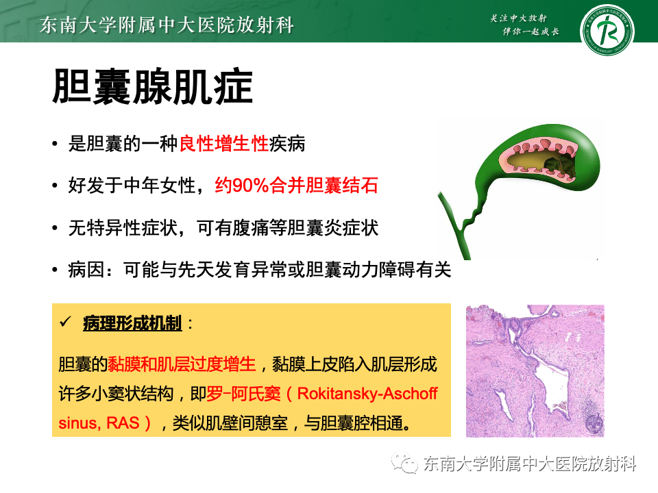 ec331da4e44aaa1751a544c49013e0cf.png