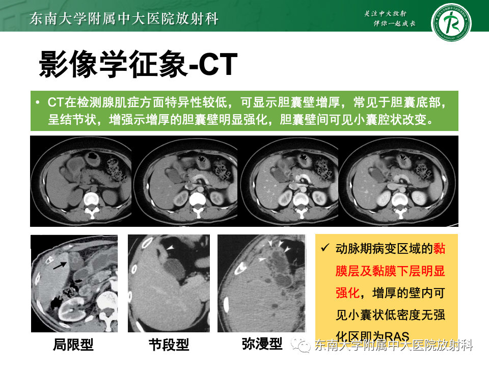 ab56cbb9246aa856bf7d4704675e4bb5.png