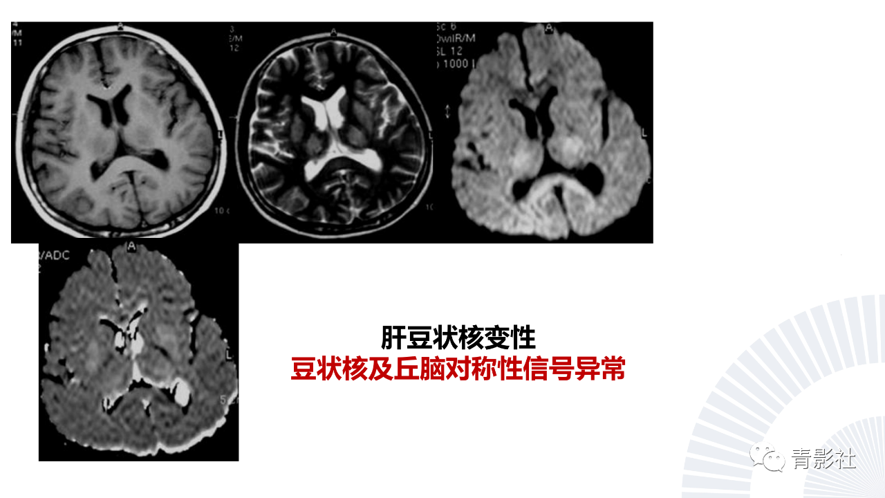019d593dc66ad930781ff229d8fb117a.png