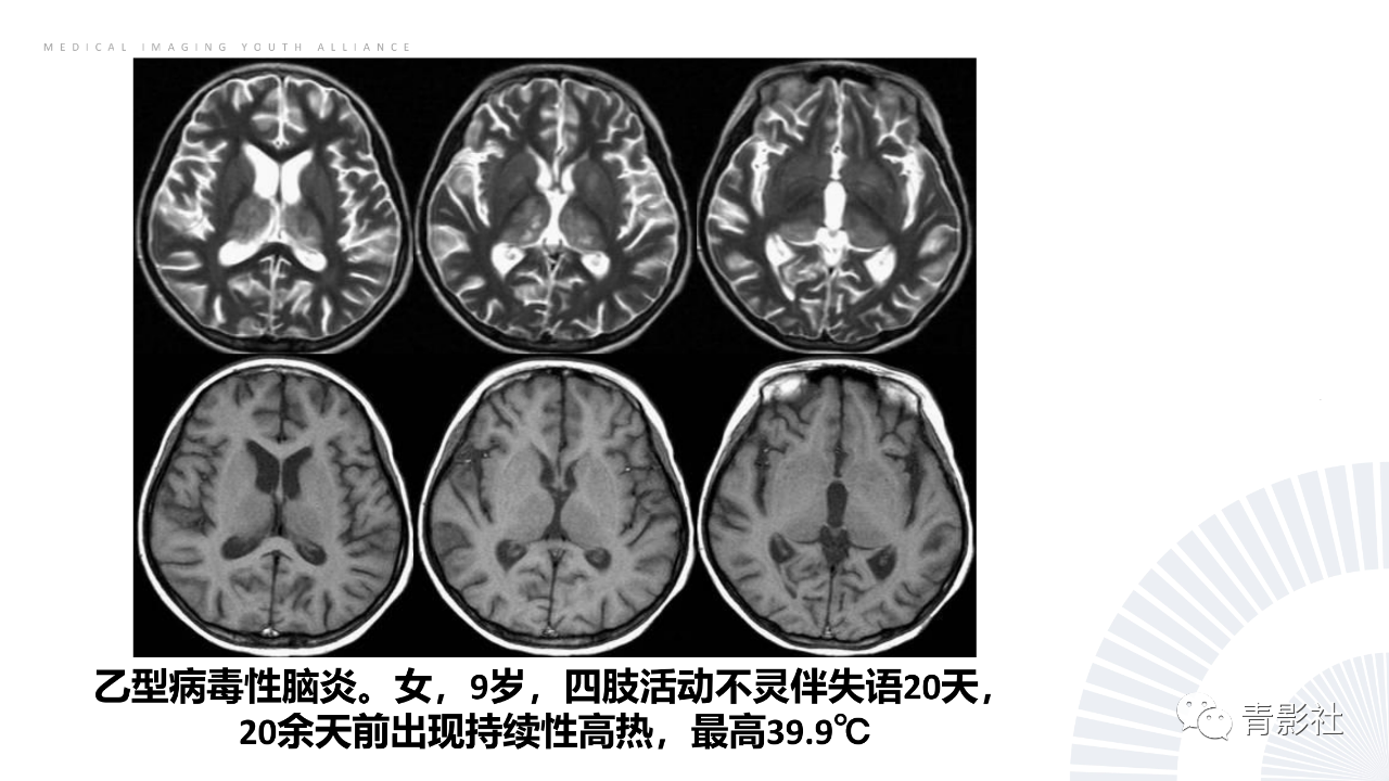 a128b104ed6aa9e02fb6d5e711c408e8.png
