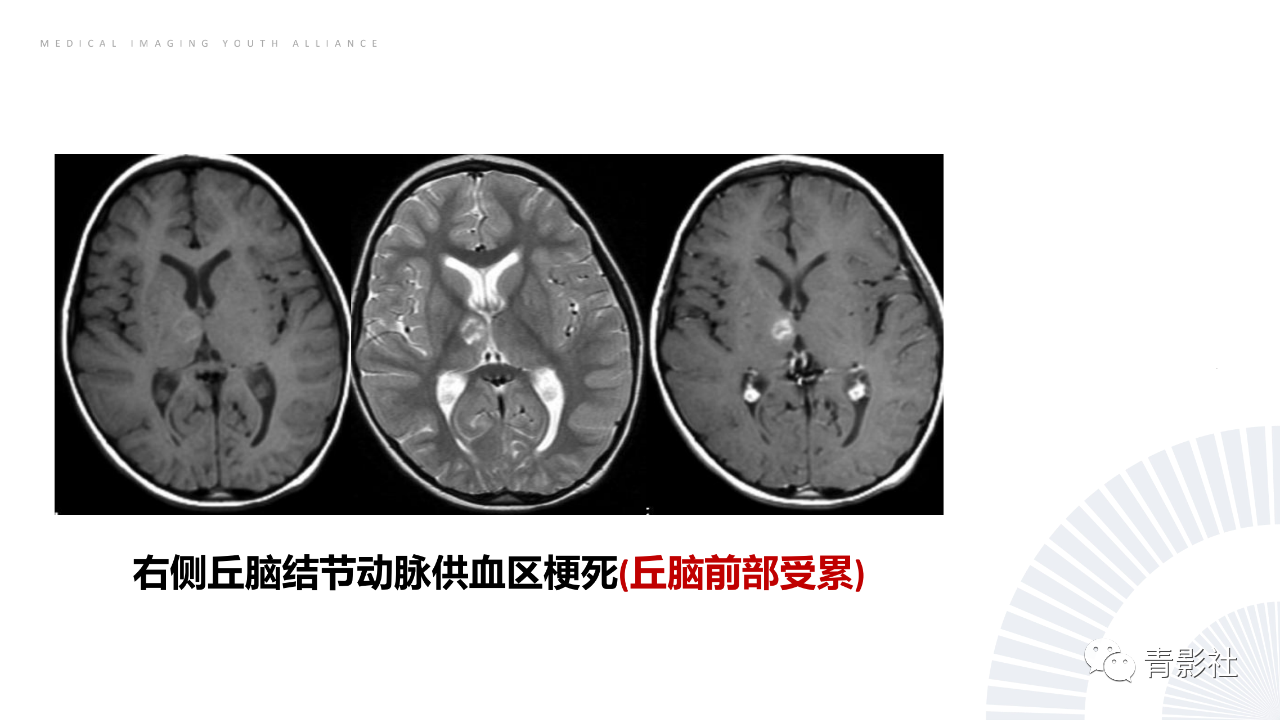 aa4e74f2dea7450a6349e8bc677be168.png