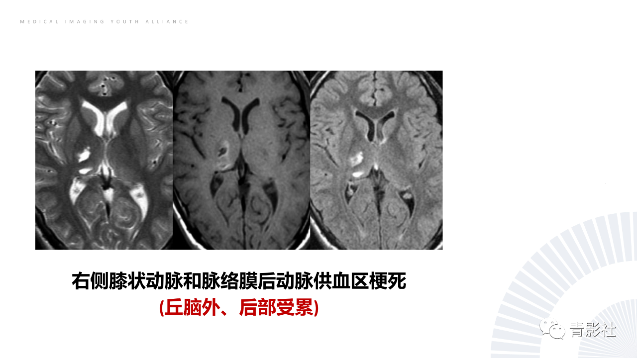 08b181d274b9291617bd91d1eabf899e.png