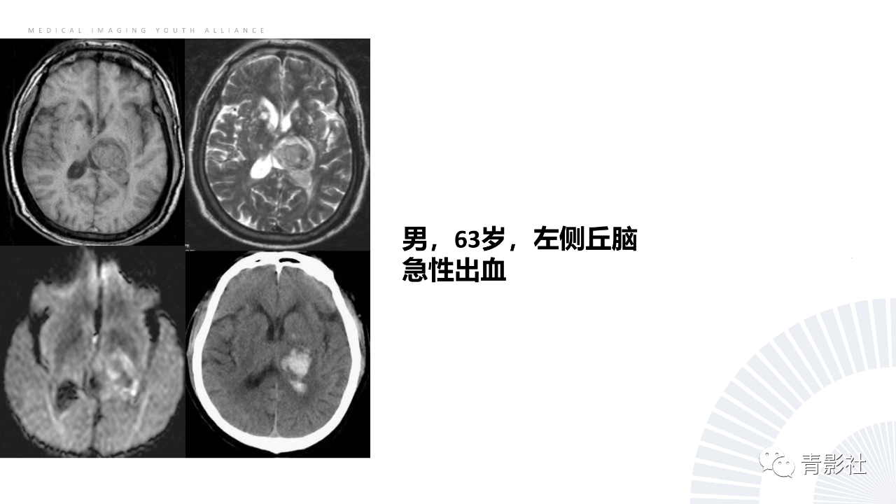 a4451c761458a4161e33a307b24fa25e.png