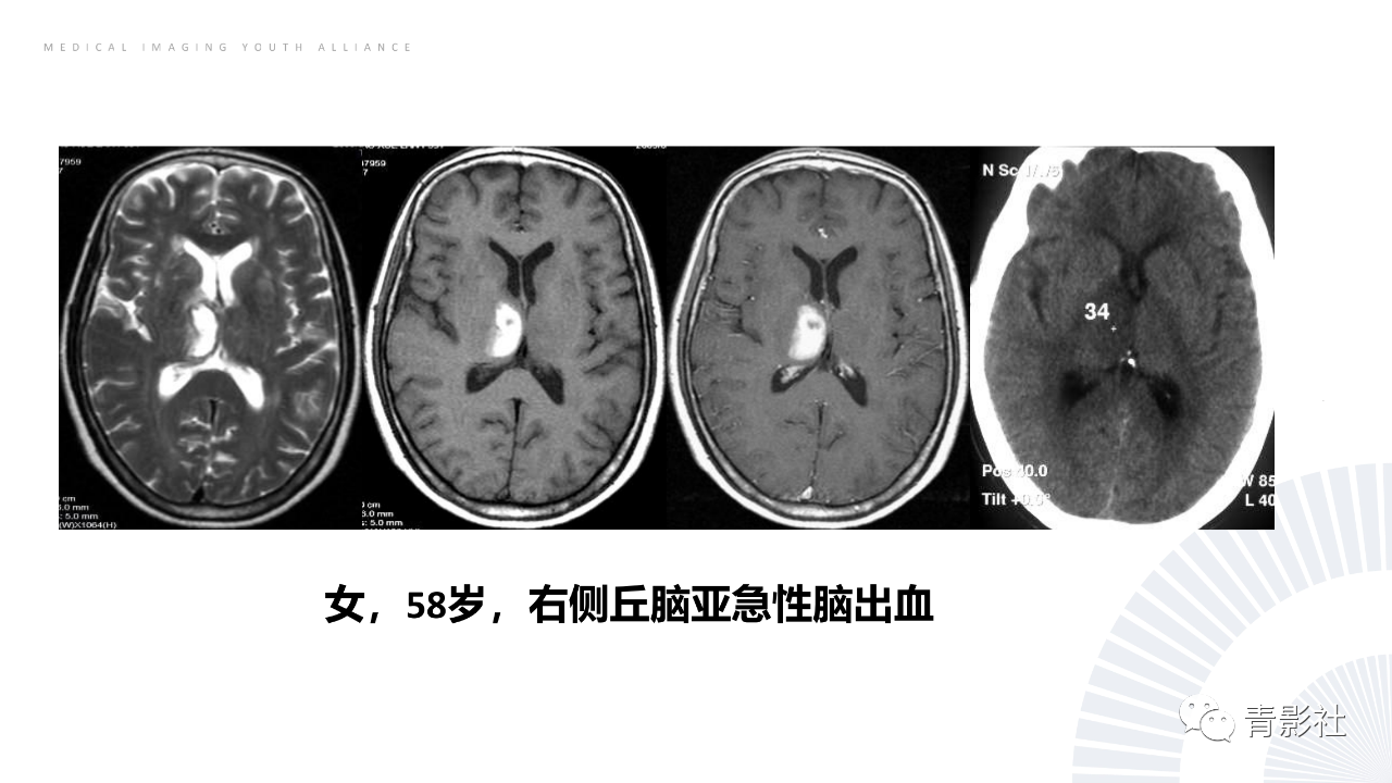06a717cd2a9df30f1c0bbdac2550b7e6.png