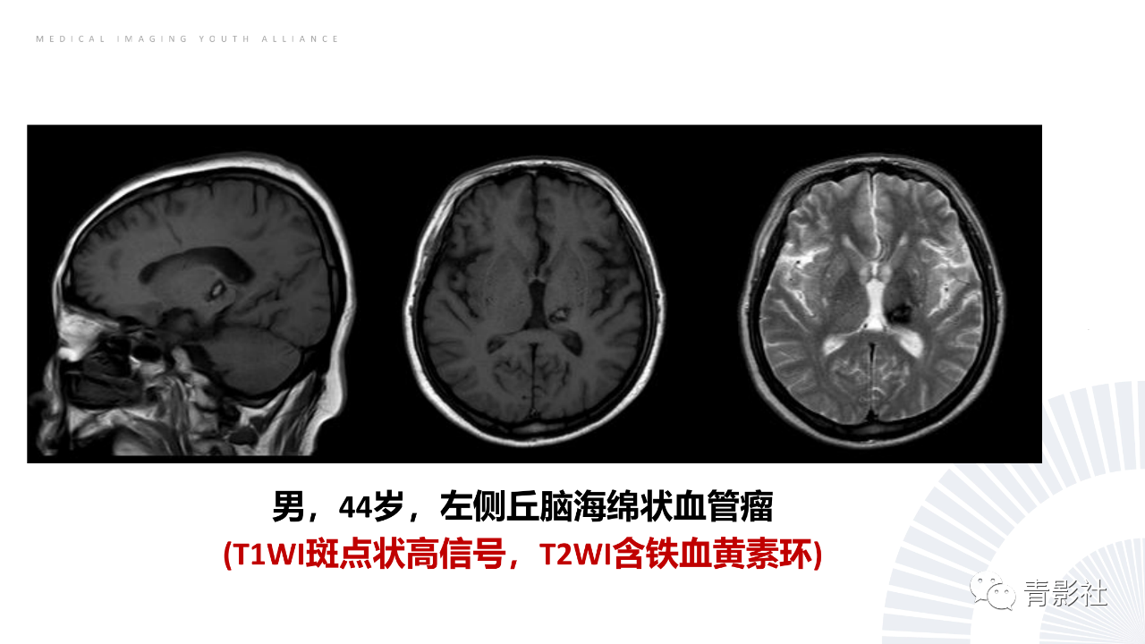 2ef8abf3d4fd78d2c314771e2e7ce3fc.png