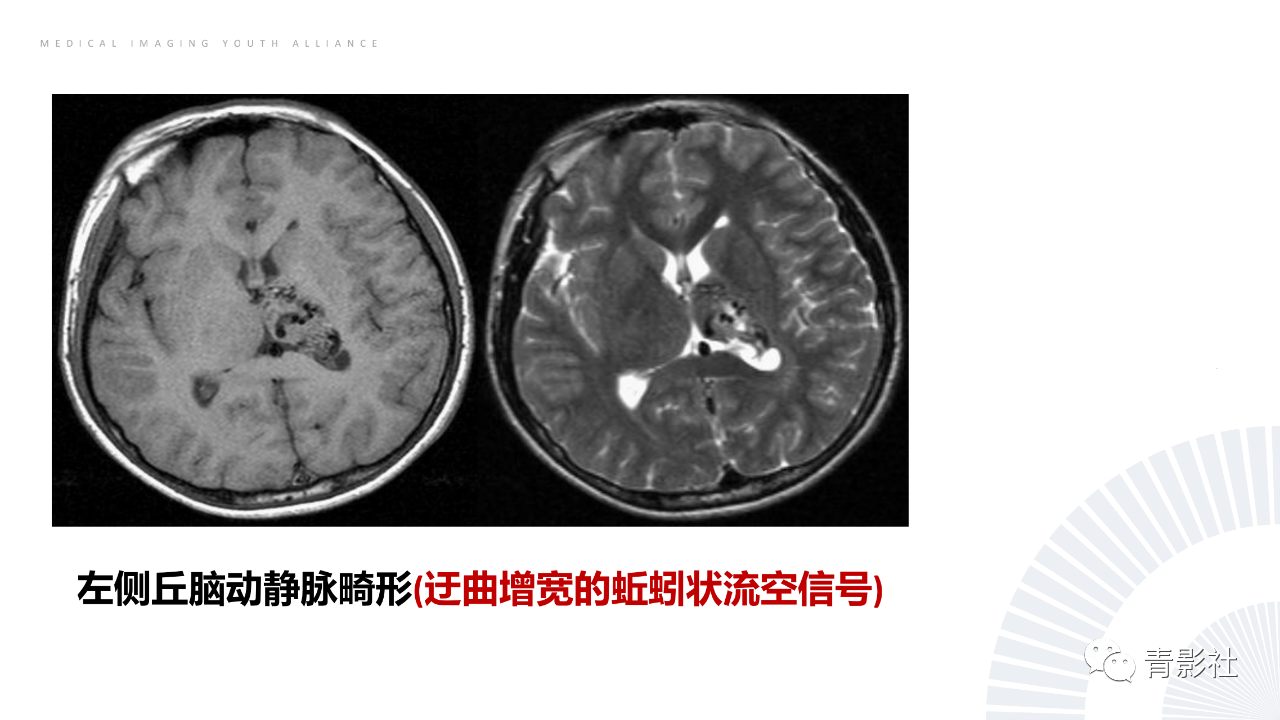 87a3bba8c820d791f530e080e3e4801d.png