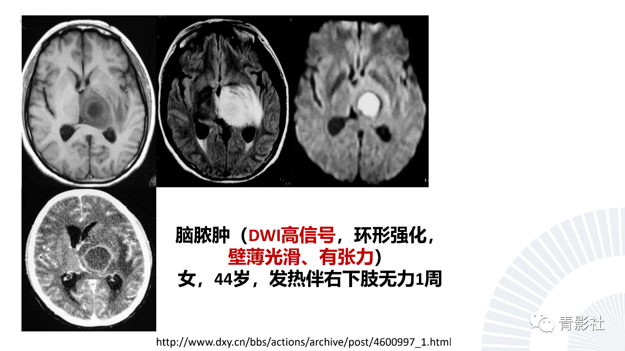 590ce272f4d4ad9e83a074345fd2908e.png