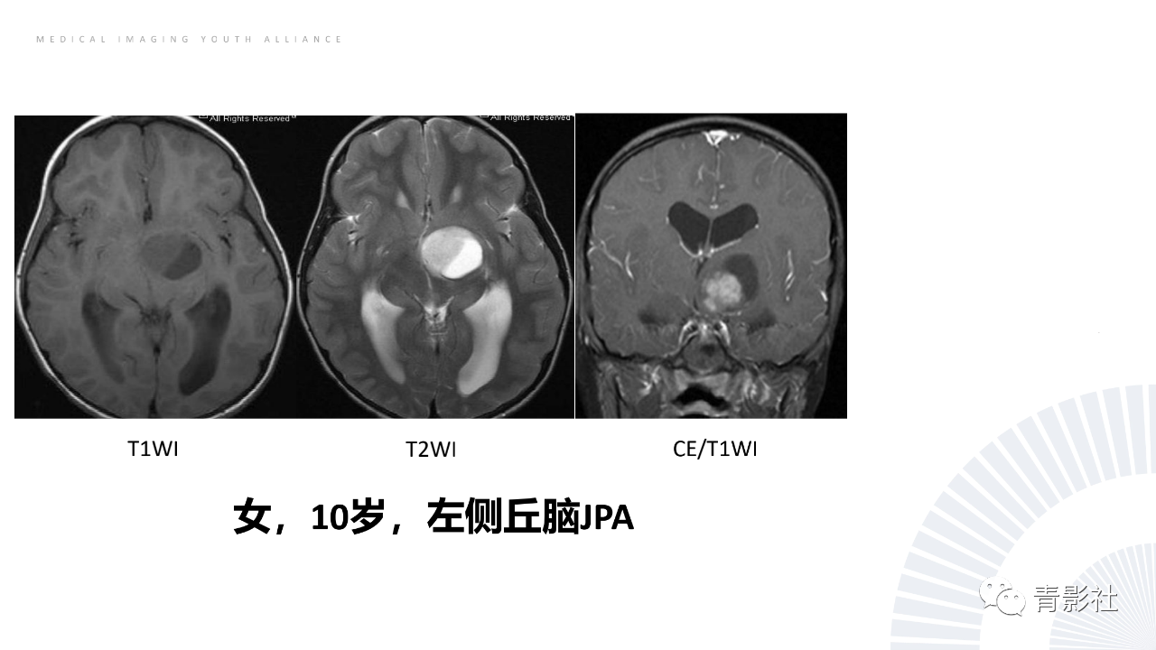 1a9ec726f777cb020c70e0cfc3a3245b.png