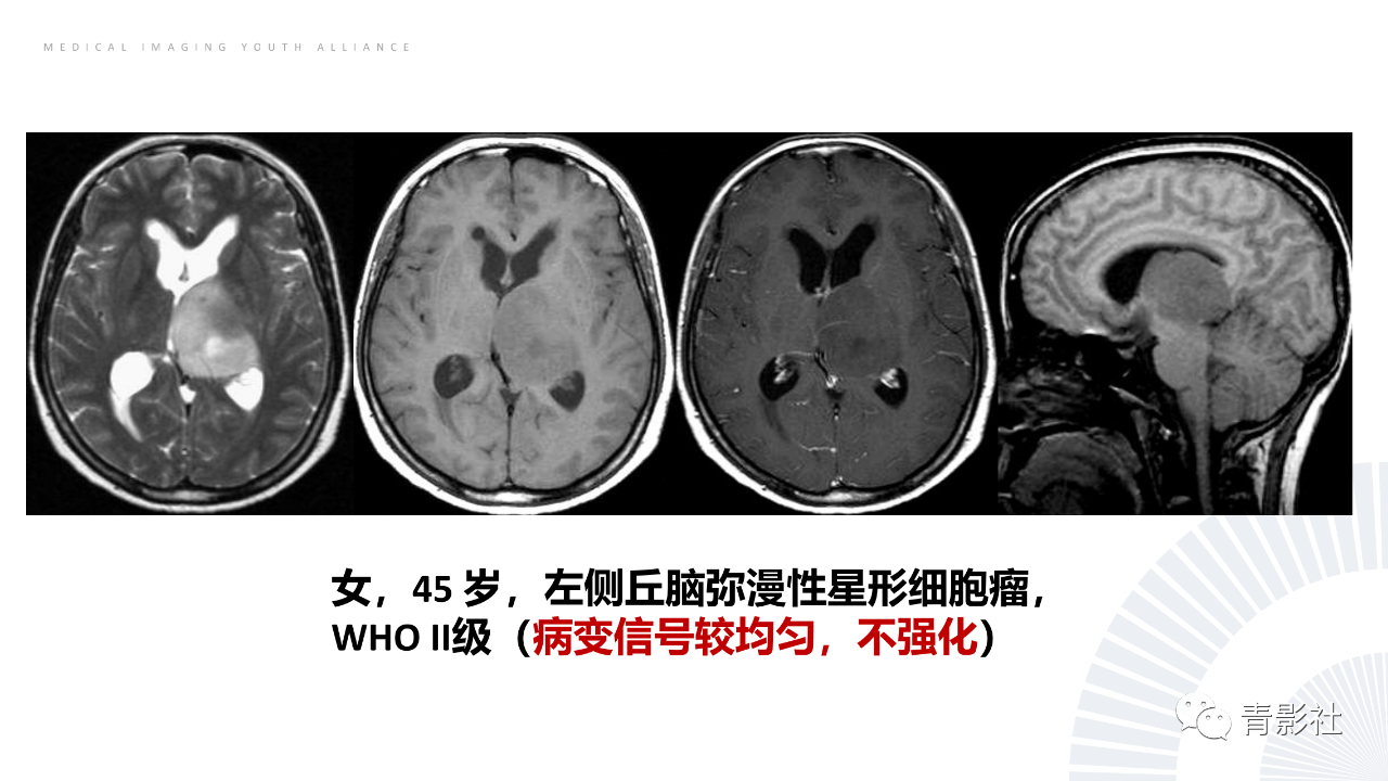 57bee65f1b9902e606ce3e9c7186ff06.png