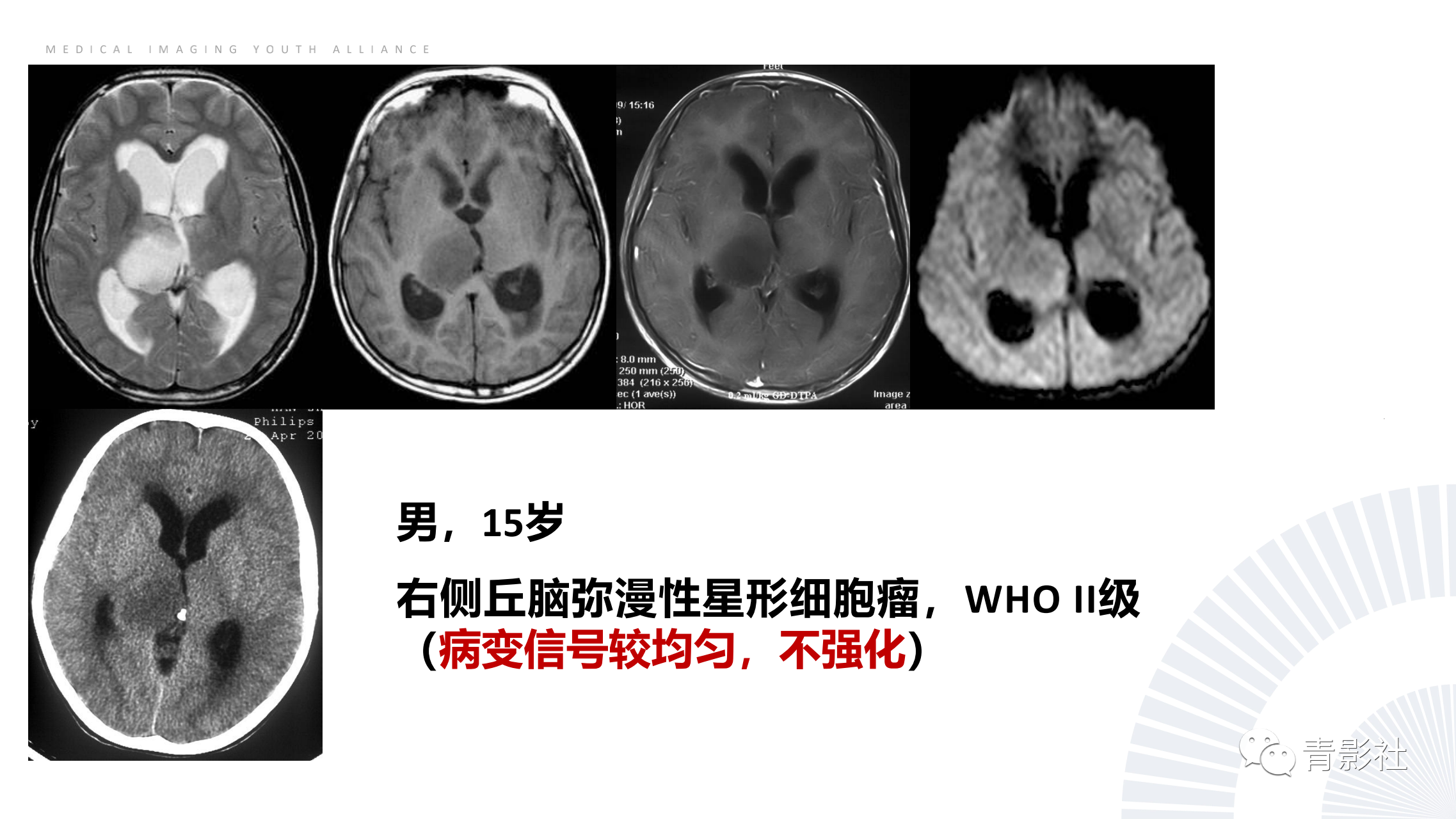 f365465ab7366c8259e00c83a571eda1.png
