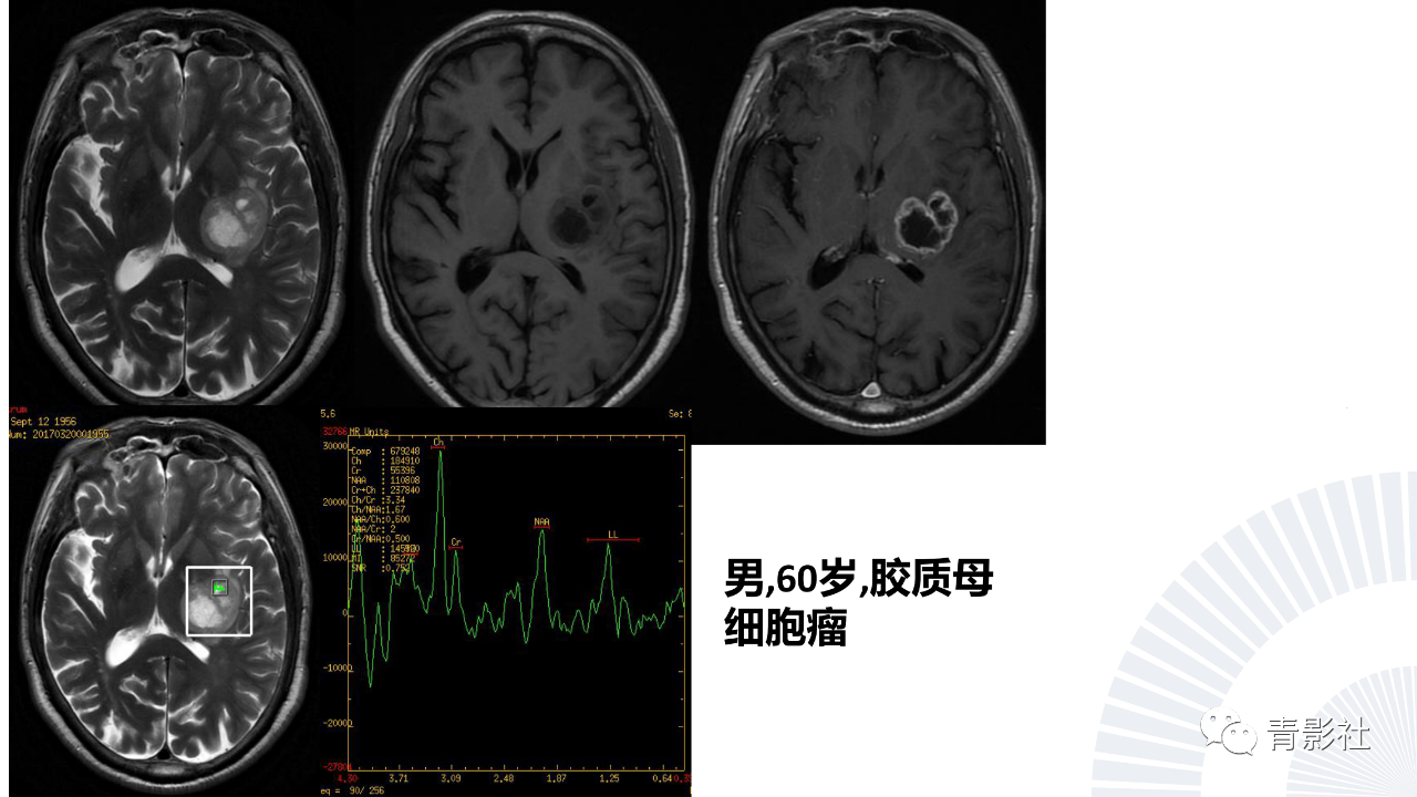 a8ef6ed5d972e598d1df676e8684f893.png