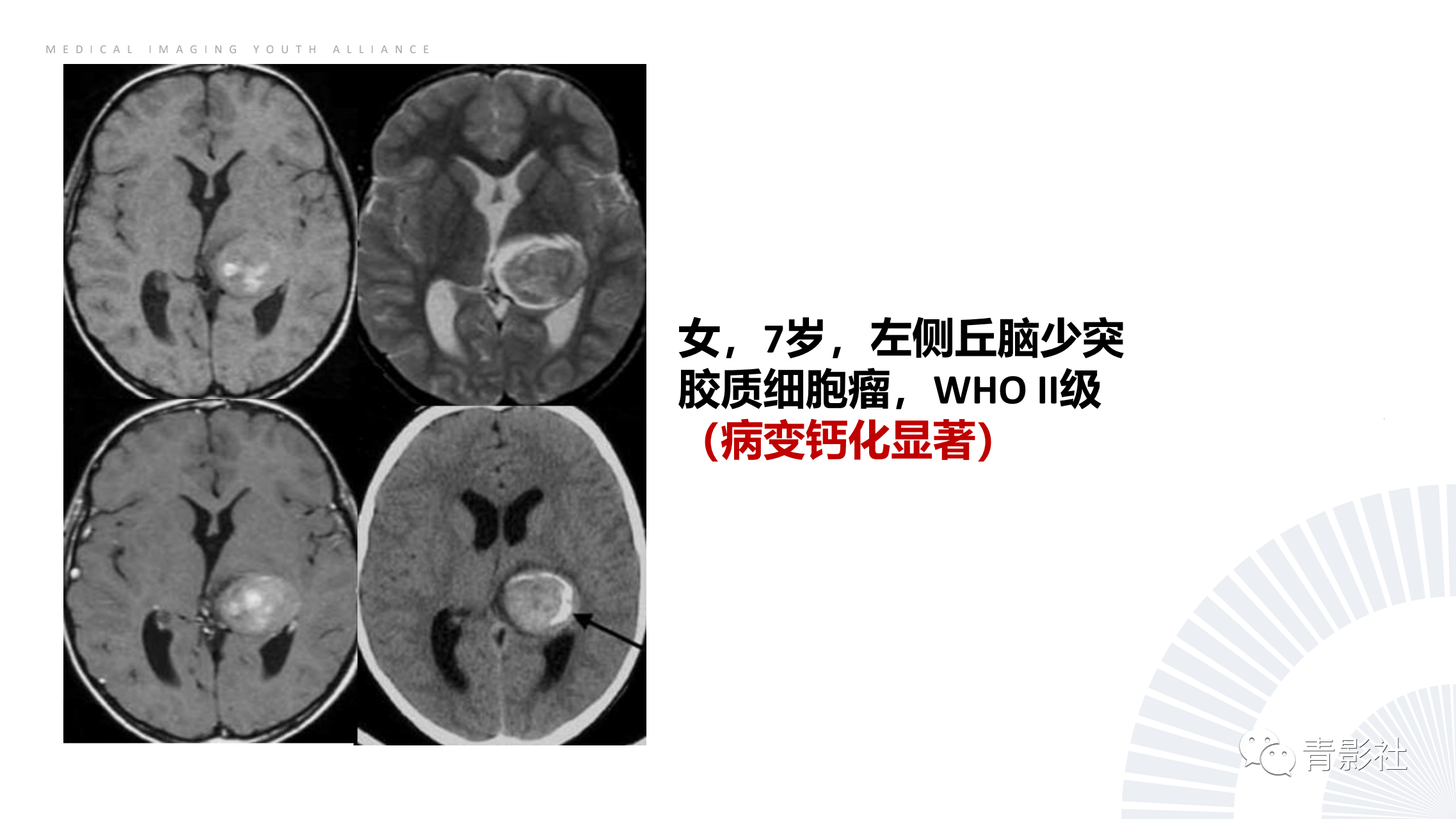 c3a5439103f080e8ba1d647258fdefbd.png