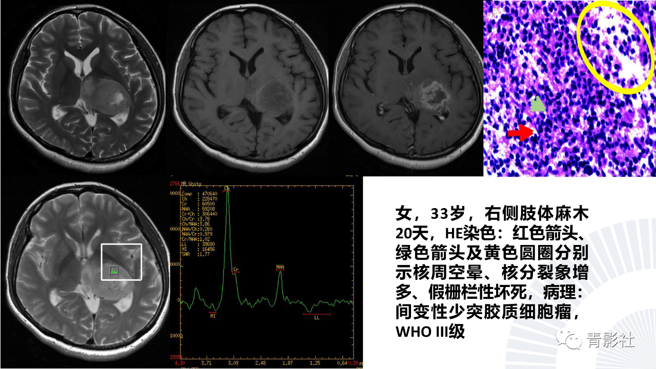 d99be79f076db212fec866e32410fb1d.png