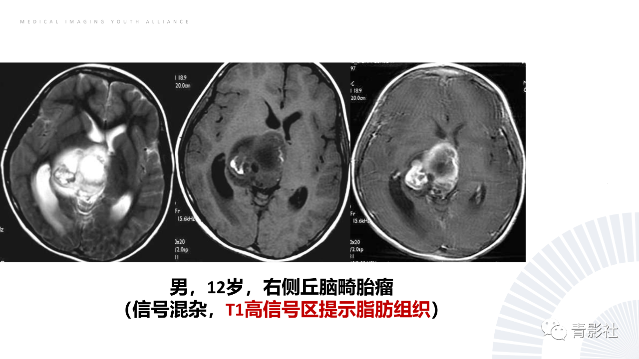 1503d652ac9750a6b1fe7e9b0a359464.png