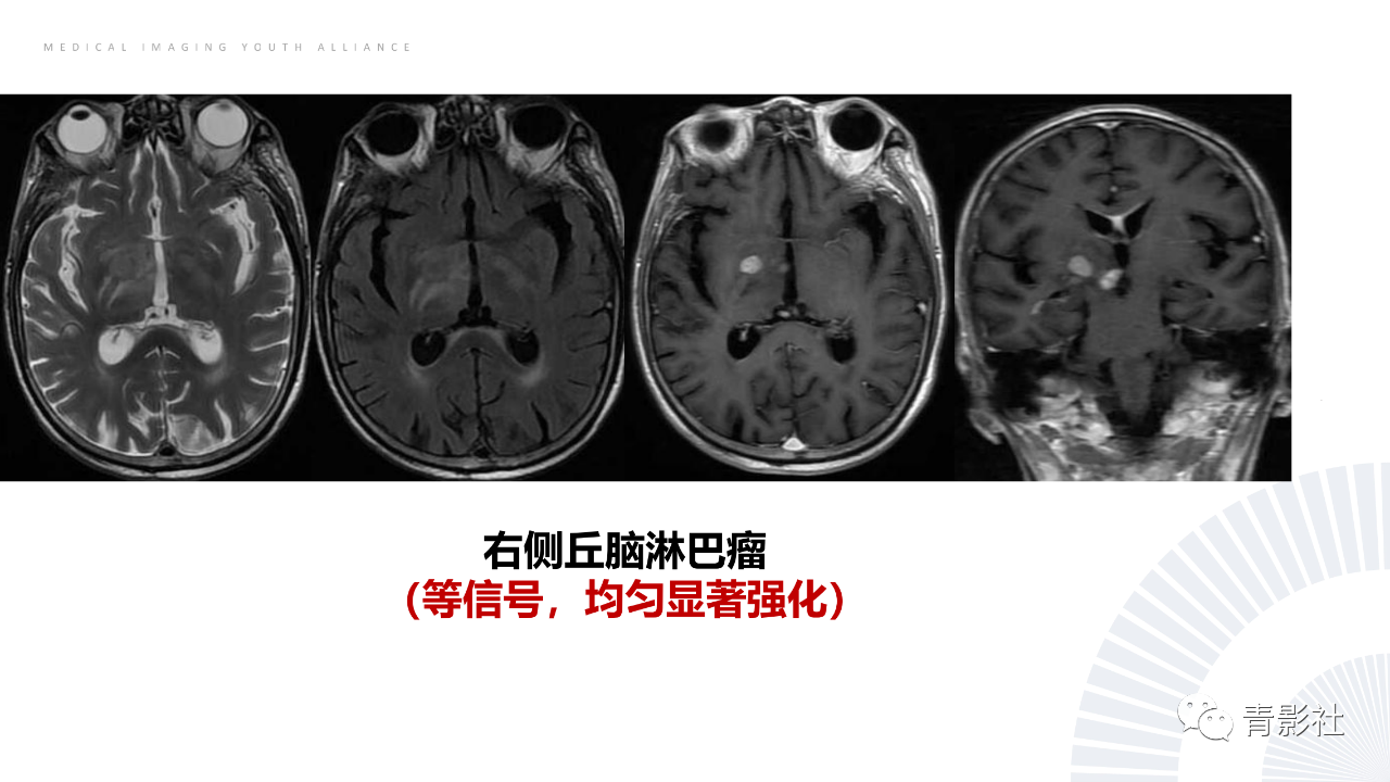 e79f72c25fc70f5da56fc1983fb6c8d9.png