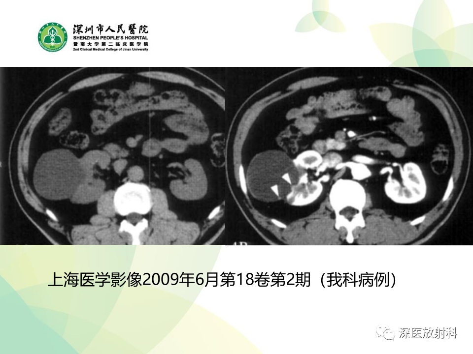 550621e9f141f0f341f2c4aafc3e7b6e.png
