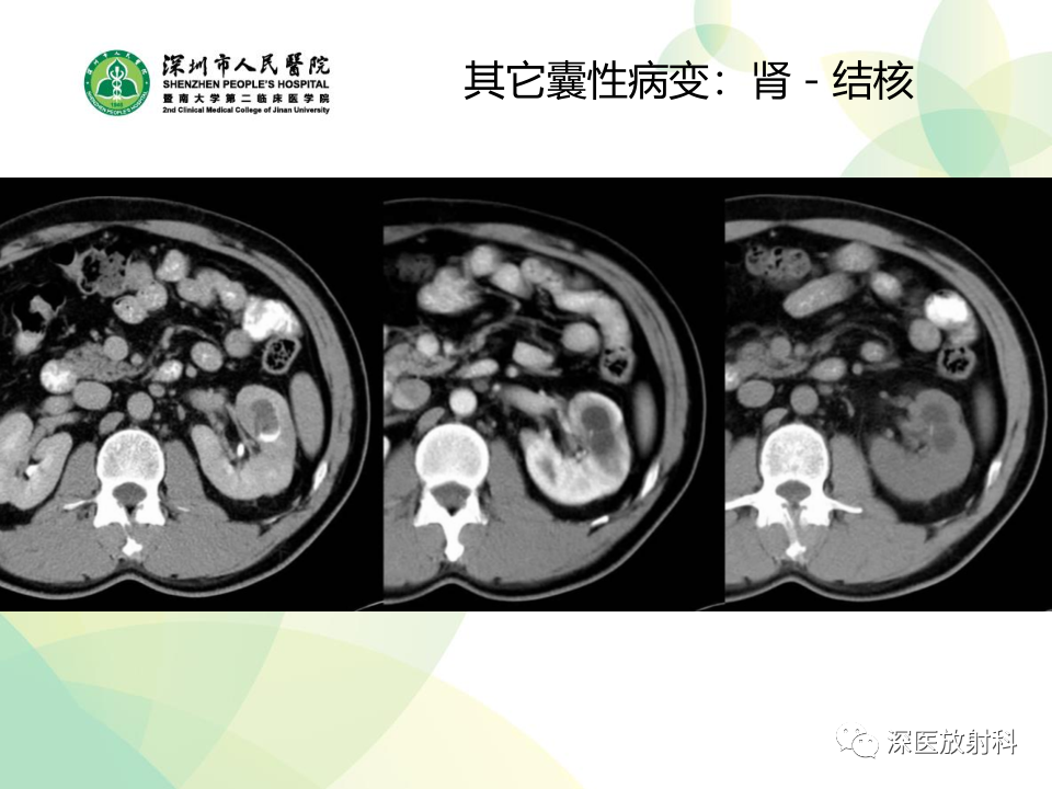 d48be2ffd34bf1e92a40ba766e59e3ca.png
