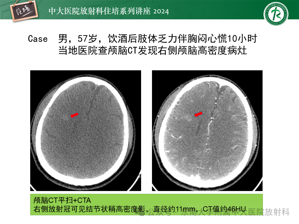 aef74b68d30de8d24381a61210d4ee36.png