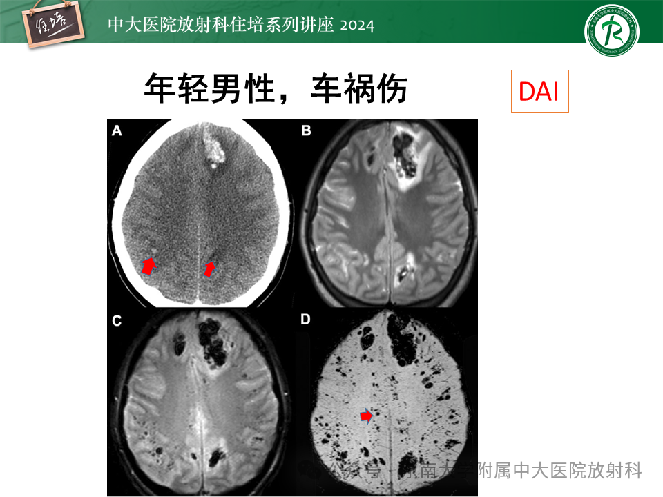 42ad7829a8a6f59cace23a5960b98413.png