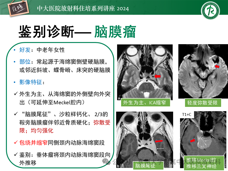 f29283a5bfd08f26d9aa3b39c4a3a8ae.png