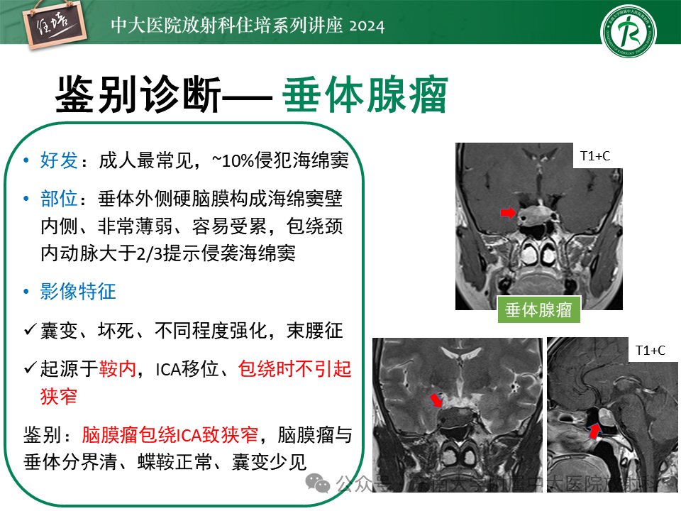 08b54ce21fc809a0a8fd68269f3394bd.png
