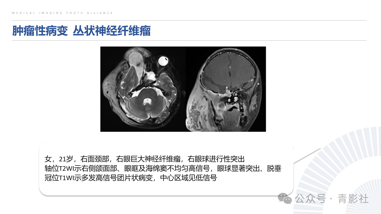 afd1c1429aad8bf7262736ee64a29f83.png