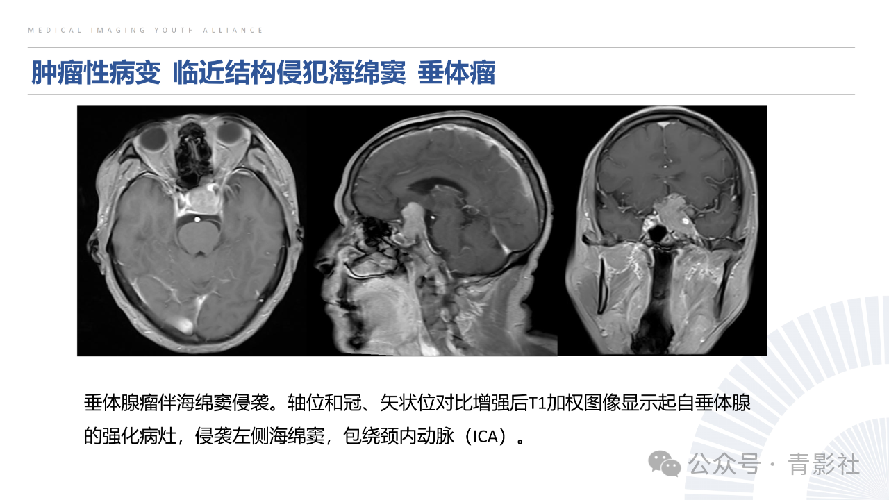 2f6a46ed7ffc671388c09e3a78e667a9.png