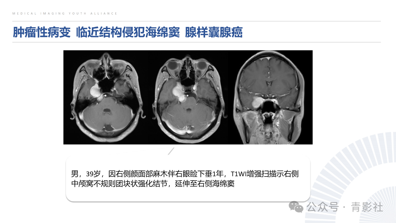 e8563ed1ac54653aaa70bb9cfad31a23.png