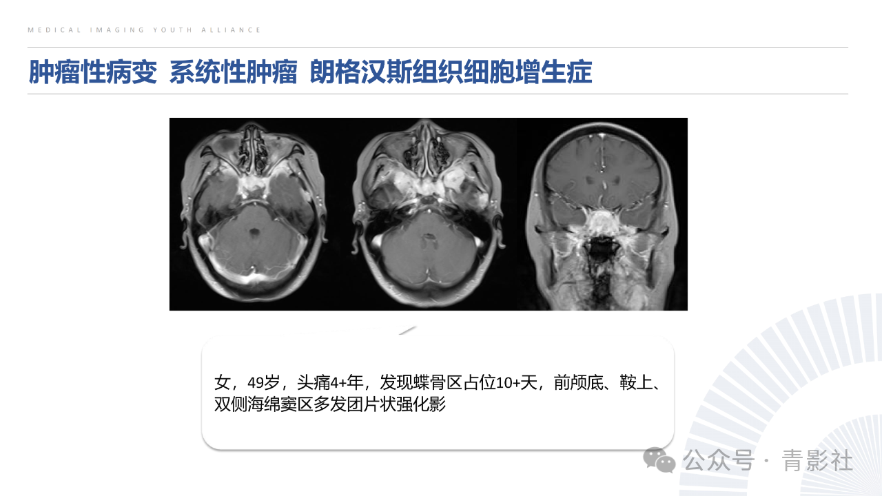 729a739484f17040c56c98b22fa345e8.png