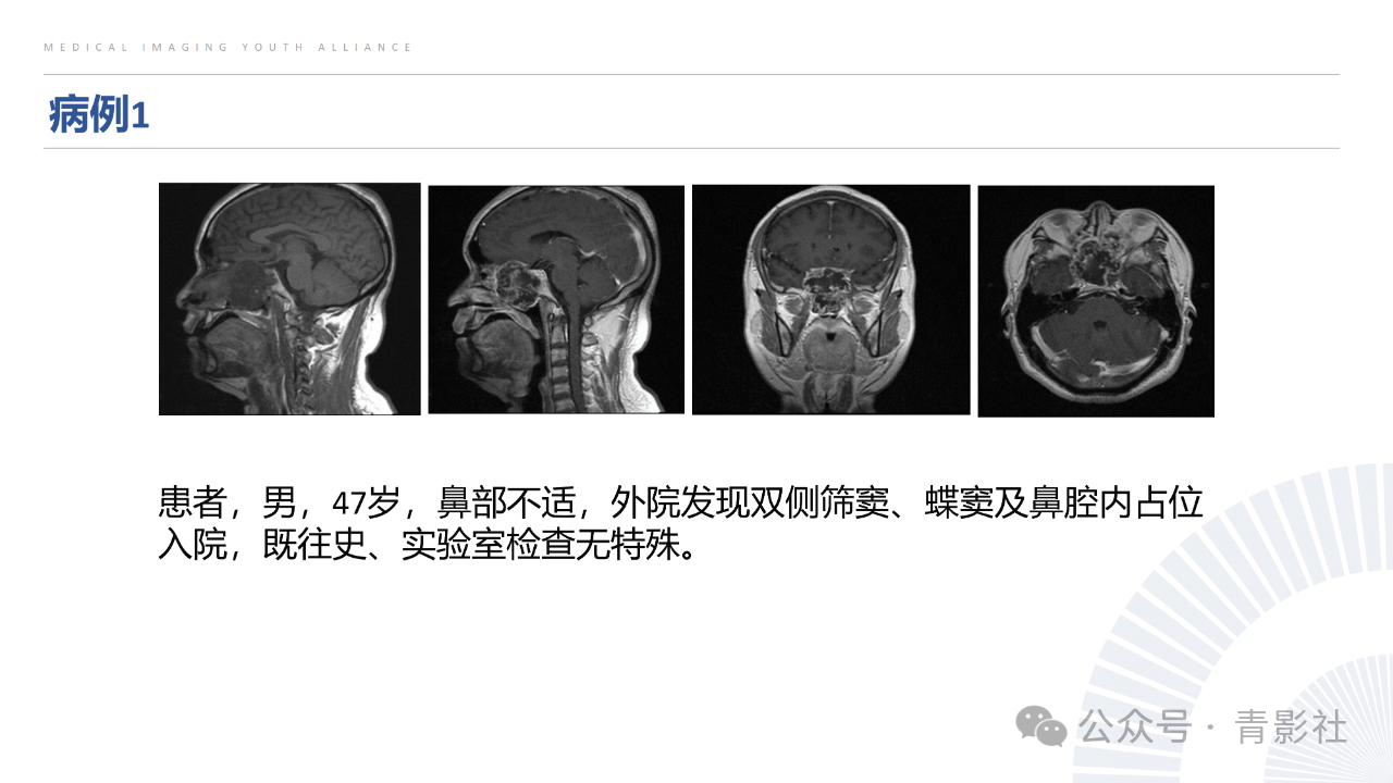 aeebd66846e6912bfceb760a83ec77c6.png