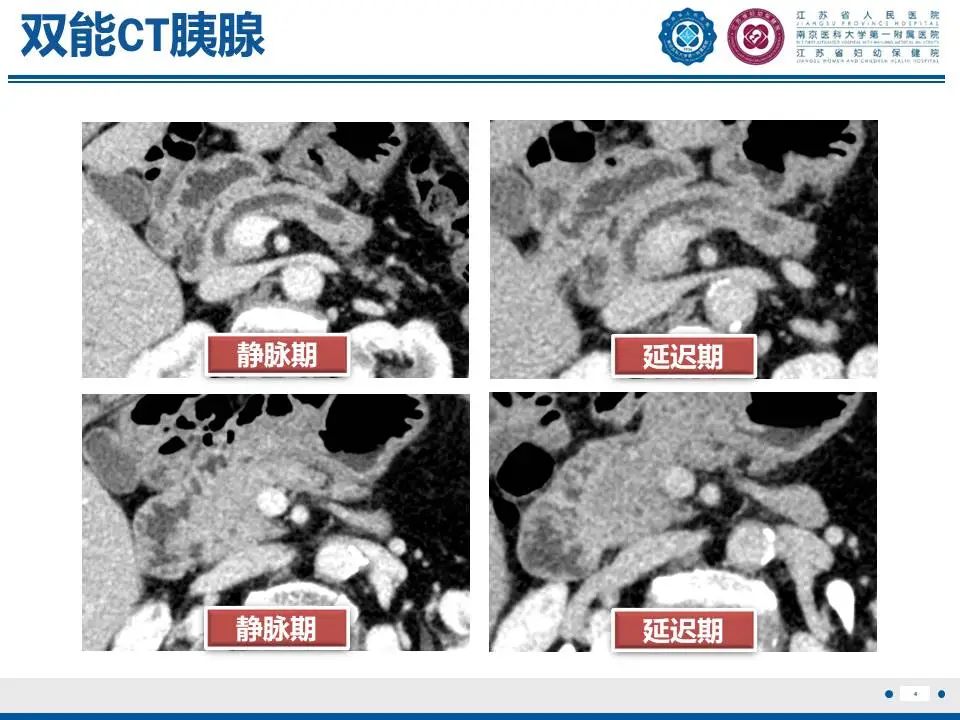 e4c9725a3dcec91d5ec0a35a442f9055.jpg
