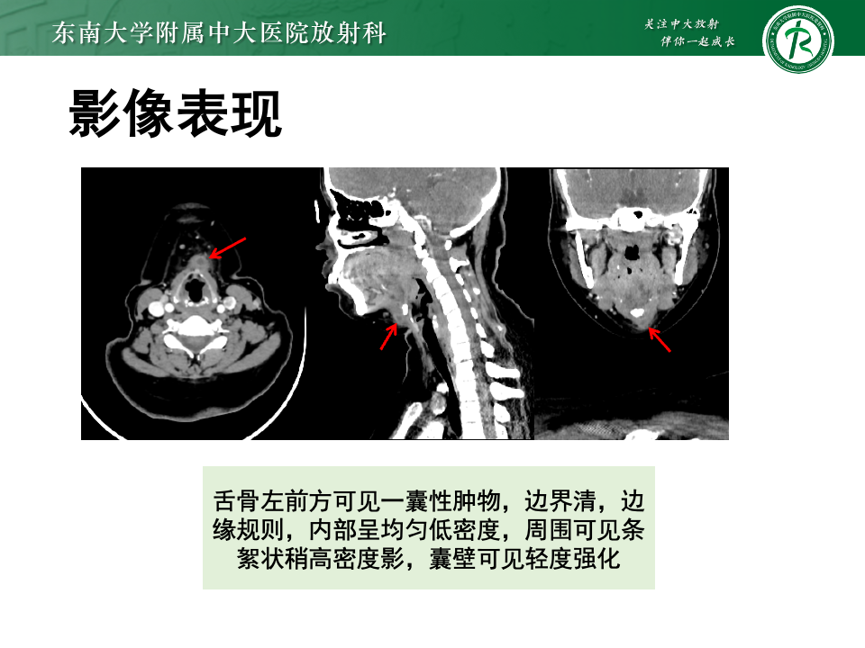 233e20cfd8ec9655fac4e53db3f13d77.png