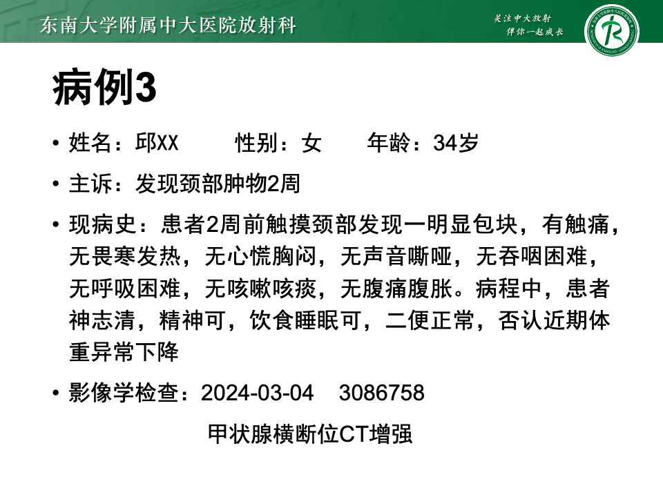 a66baa647a8d15adeff55cdd2281a243.png