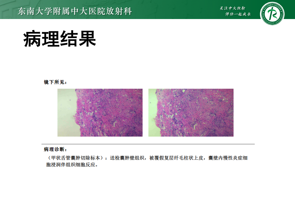 a11b4670b78d8bf855a7e11a17c852f5.png