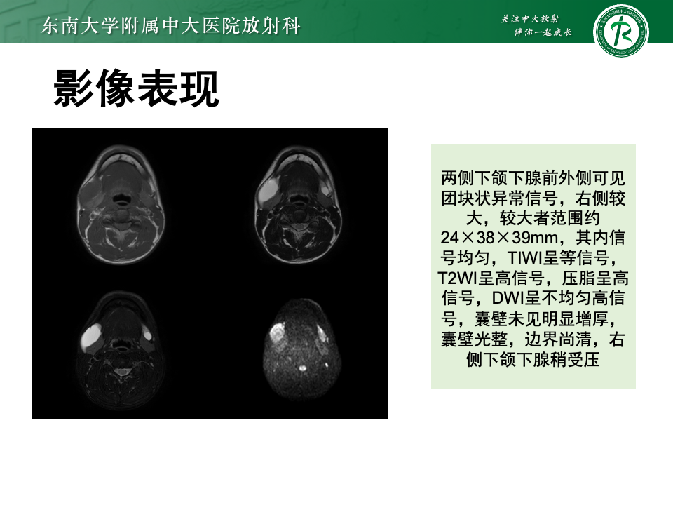 c9488e8371b74d4225e5ebb79da0204c.png