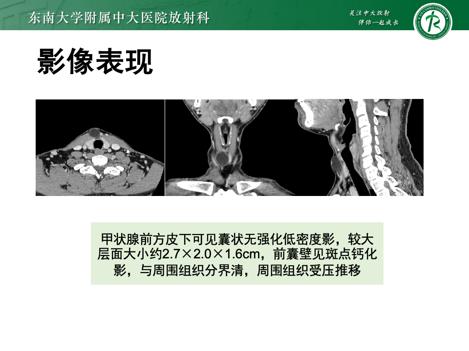 dcb932251a42ff766f4ac827115994ec.png